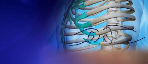 Slipping rib syndrome - Check causes, types, treatment and symptoms with quiz for free. . Doctors who treat slipping rib syndrome near me
